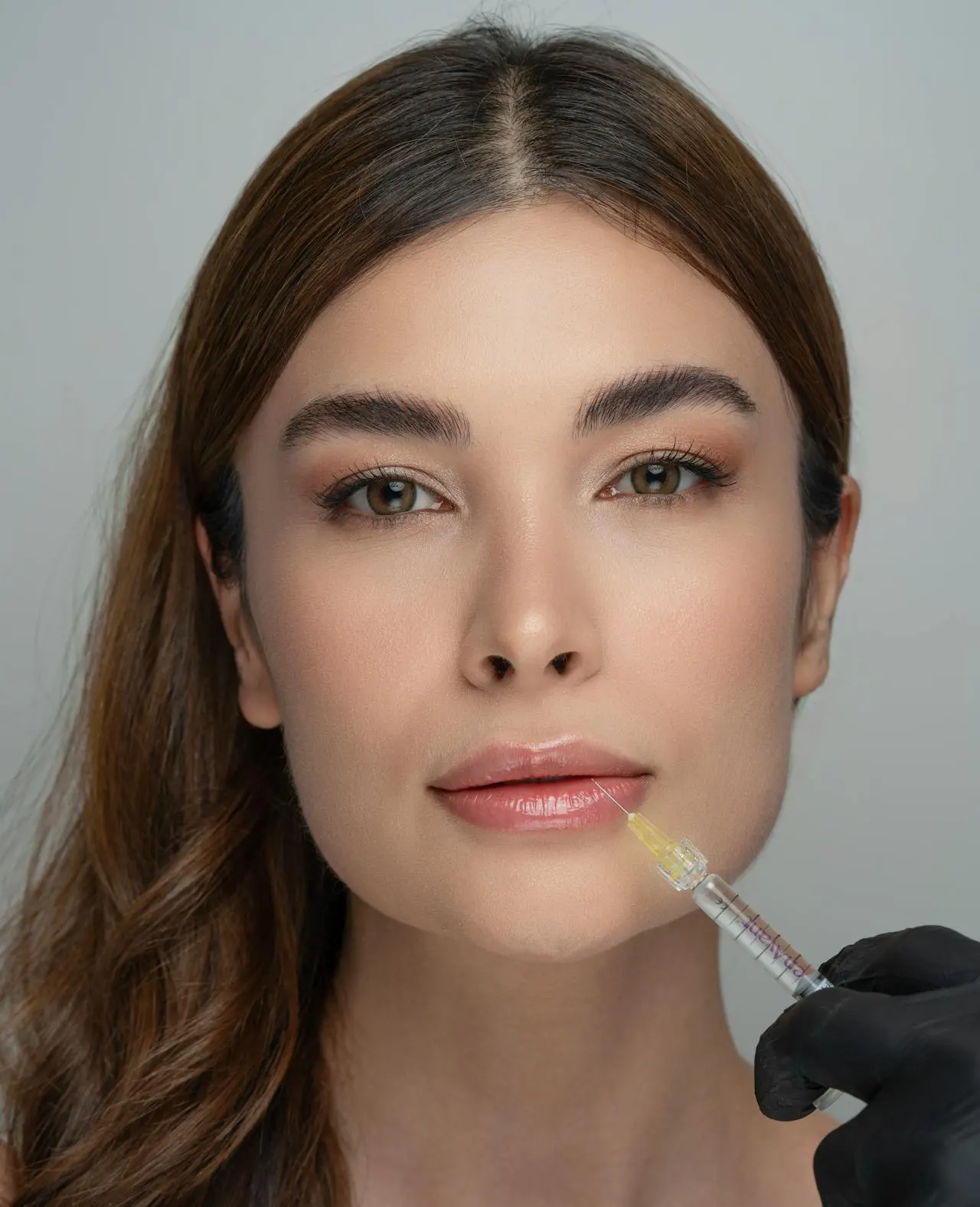 Client consultation for dermal fillers at Crowfoot Calgary clinic