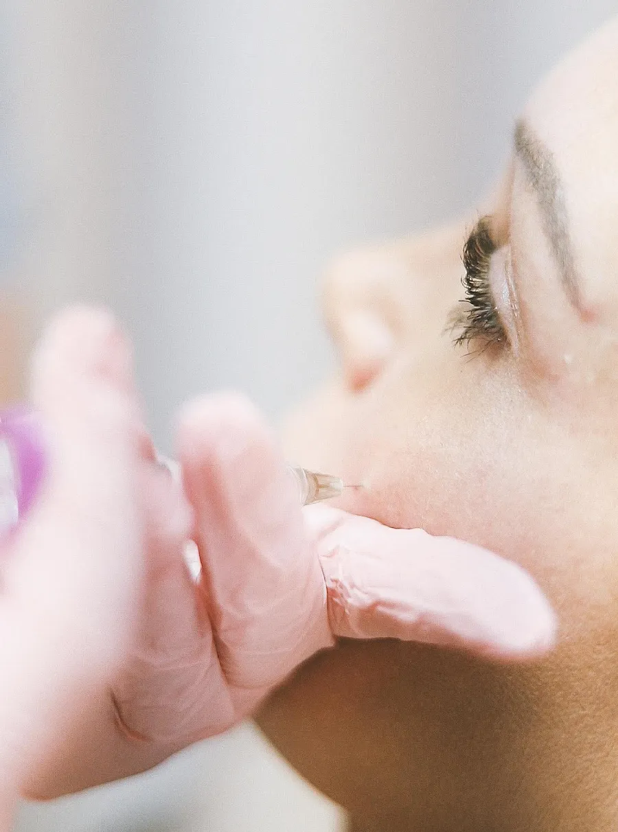 Natural facial contour after dermal filler treatment in Calgary